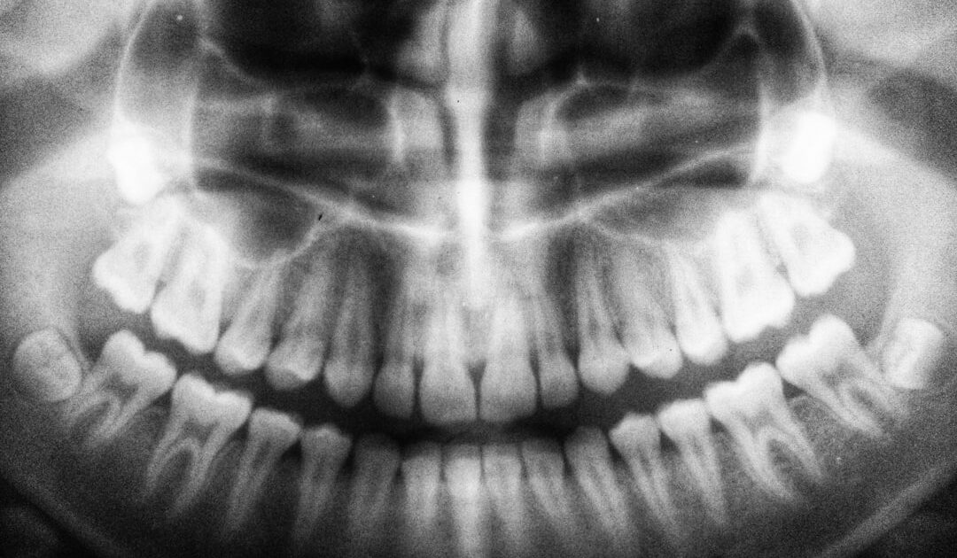 « C’est plus cher quand on va chez le dentiste » : pour Dyson, sa brosse à dents à 479 euros n’est pas trop chère