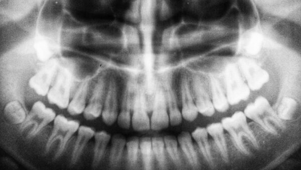 « C’est plus cher quand on va chez le dentiste » : pour Dyson, sa brosse à dents à 479 euros n’est pas trop chère