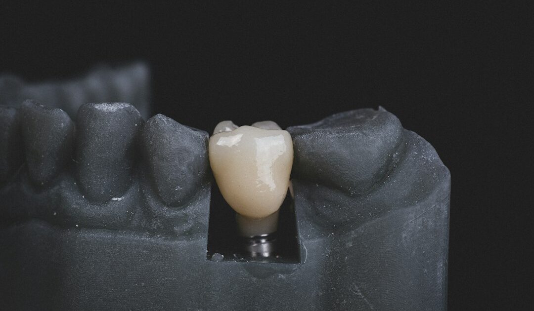 Implants cérébraux : plus d’un milliard de dollars levés en 2026, Neuralink n’est plus seul