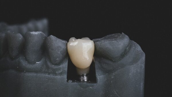 Implants cérébraux : plus d’un milliard de dollars levés en 2026, Neuralink n’est plus seul